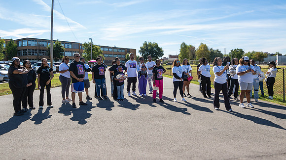 Alopecia Walk 2026-19