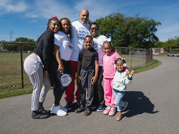 Alopecia Walk 2026-52
