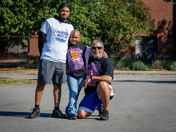 Alopecia Walk 2026-7