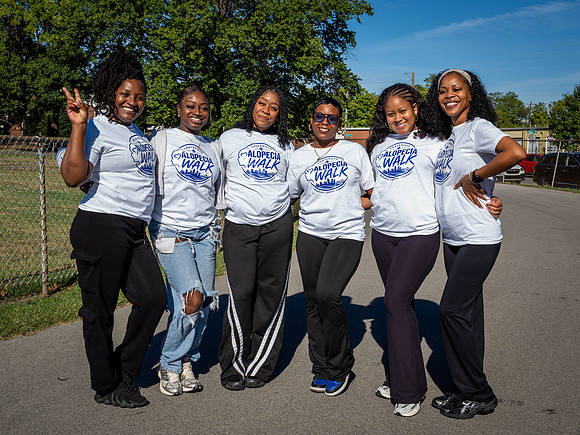Alopecia Walk 2026-3