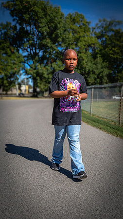 Alopecia Walk 2026-34