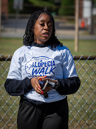 Alopecia Walk 2026-21